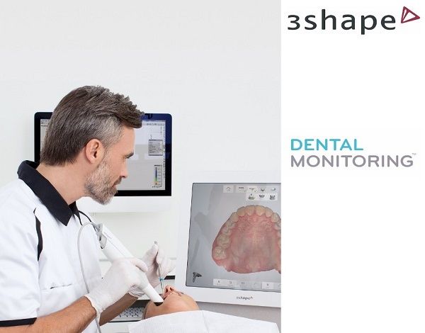 Dental Monitoring application dentistry