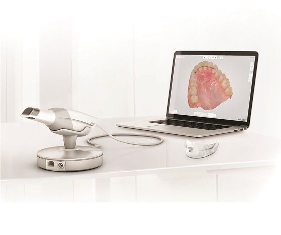 TRIOS intraoral scanner and the software