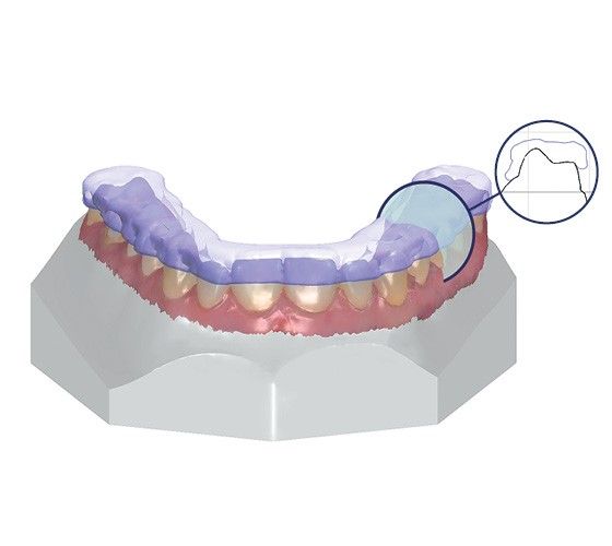 3Shape Ortho System software