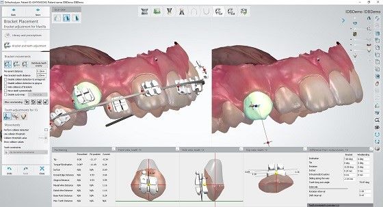 3Shape Ortho System