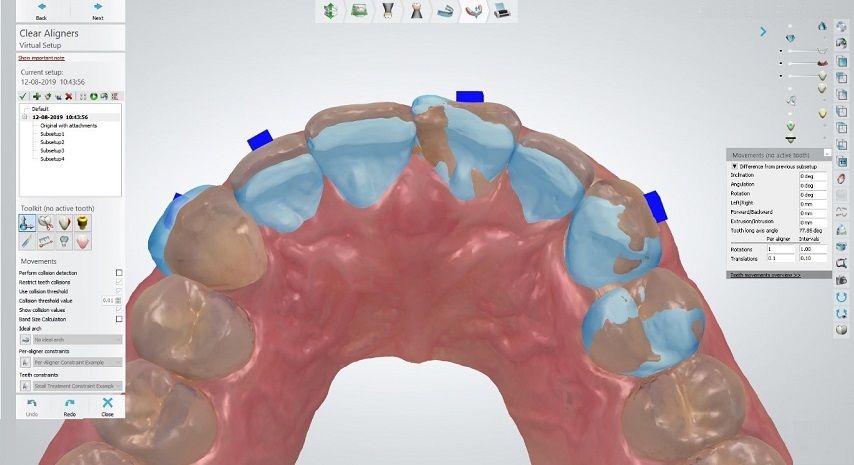 3Shape Clear Aligner Studio ortho solution demo