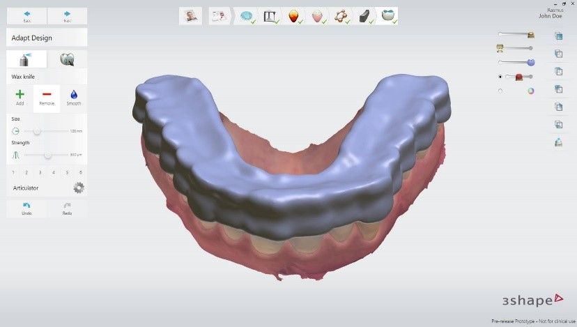 3Shape Splint Studio splint design software