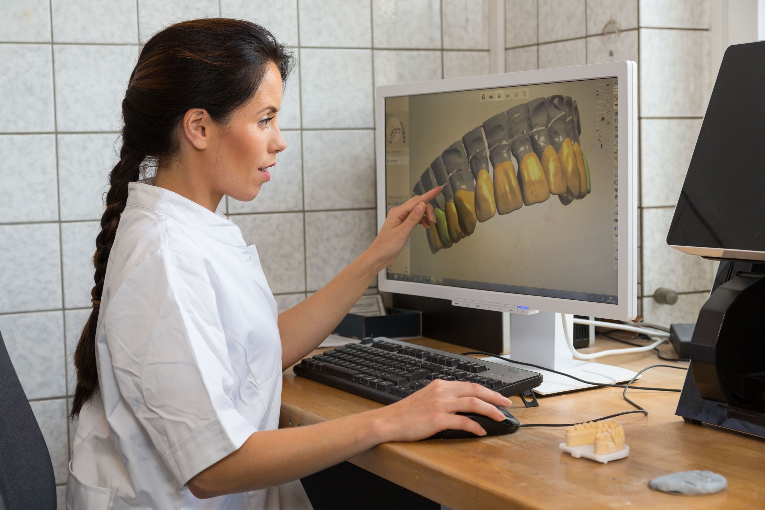 dental lab scanner and software