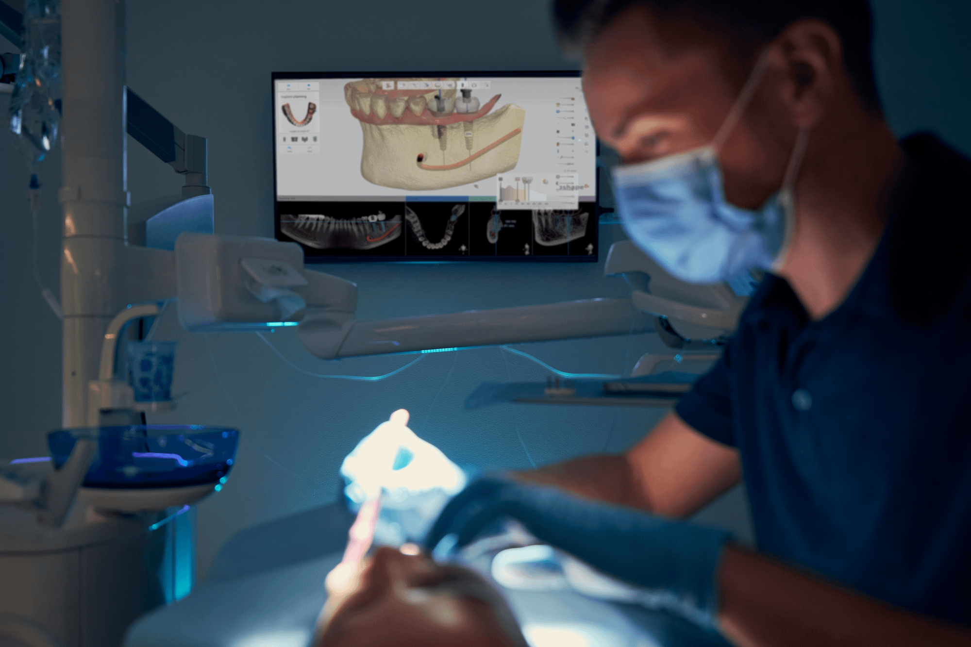 benefits of surgical guides for dental implants 