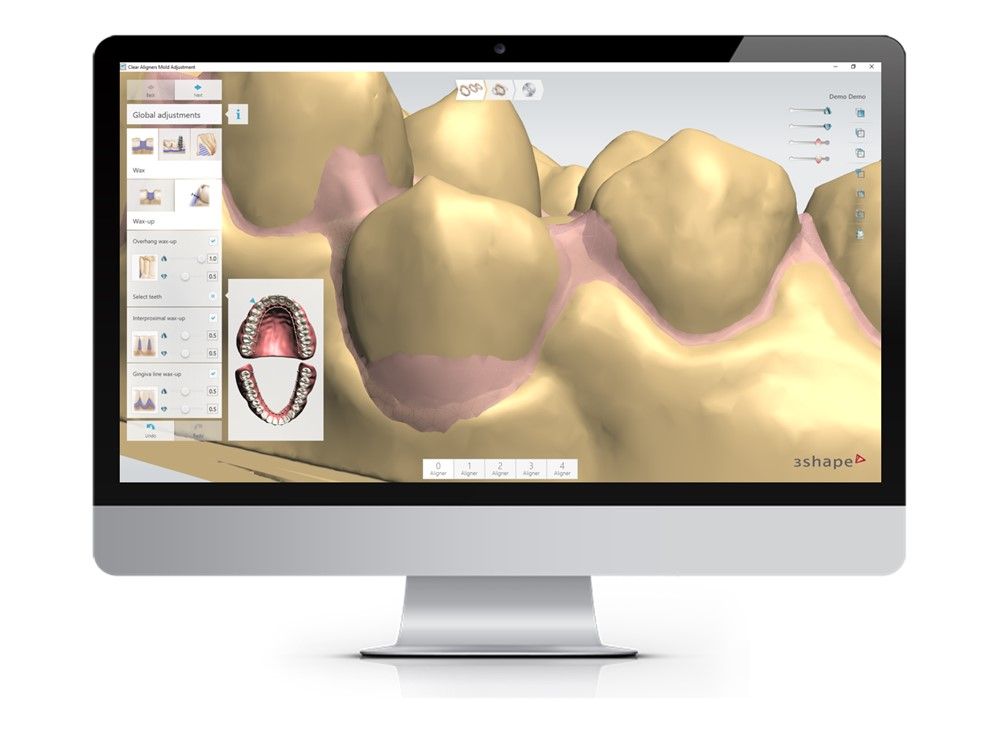 3Shape Ortho System — Software Improvement and Changes