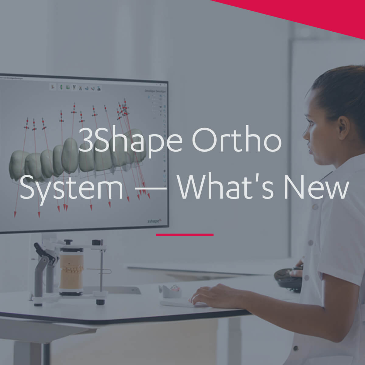 3Shape Ortho System — Software Improvement and Changes