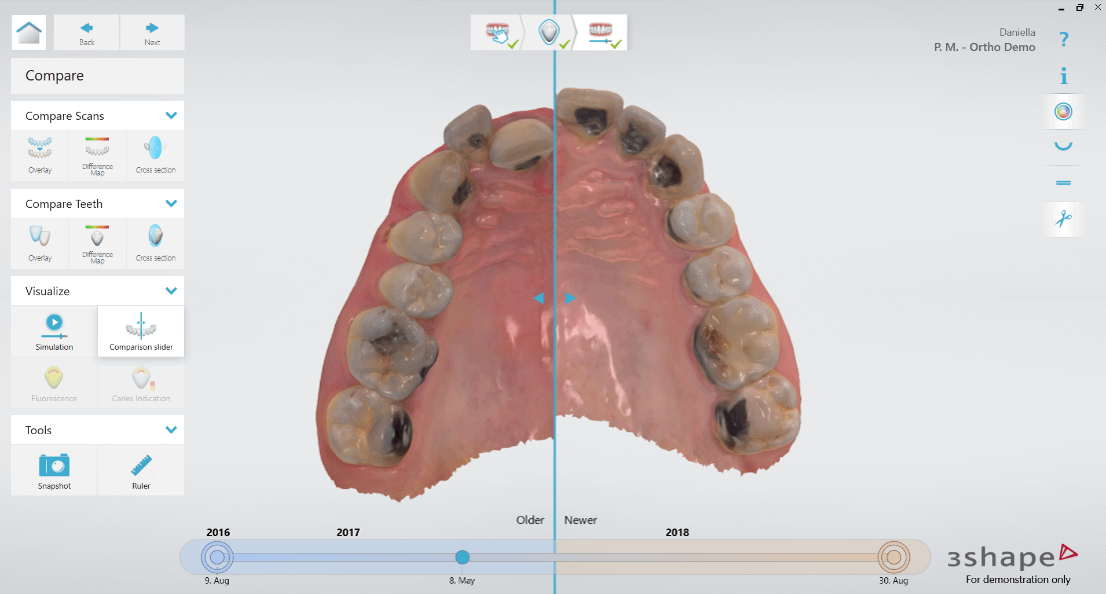 Comparison Slider 