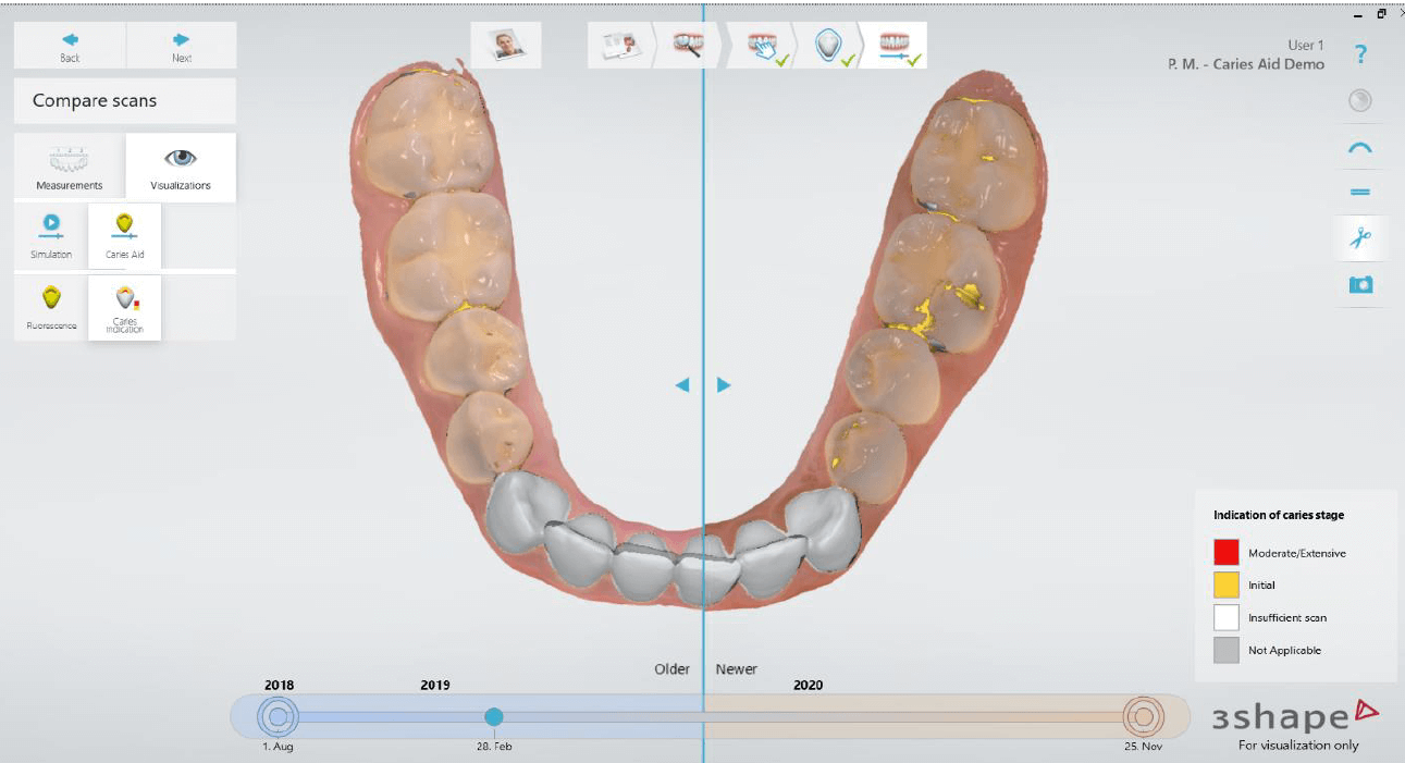 before and after slider Patient Monitoring