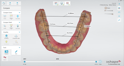 Ruler for Scan Measurements