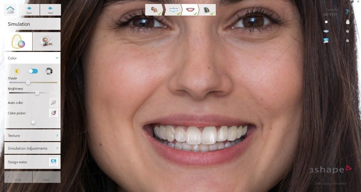 Revamped left panel interface in Smile Design