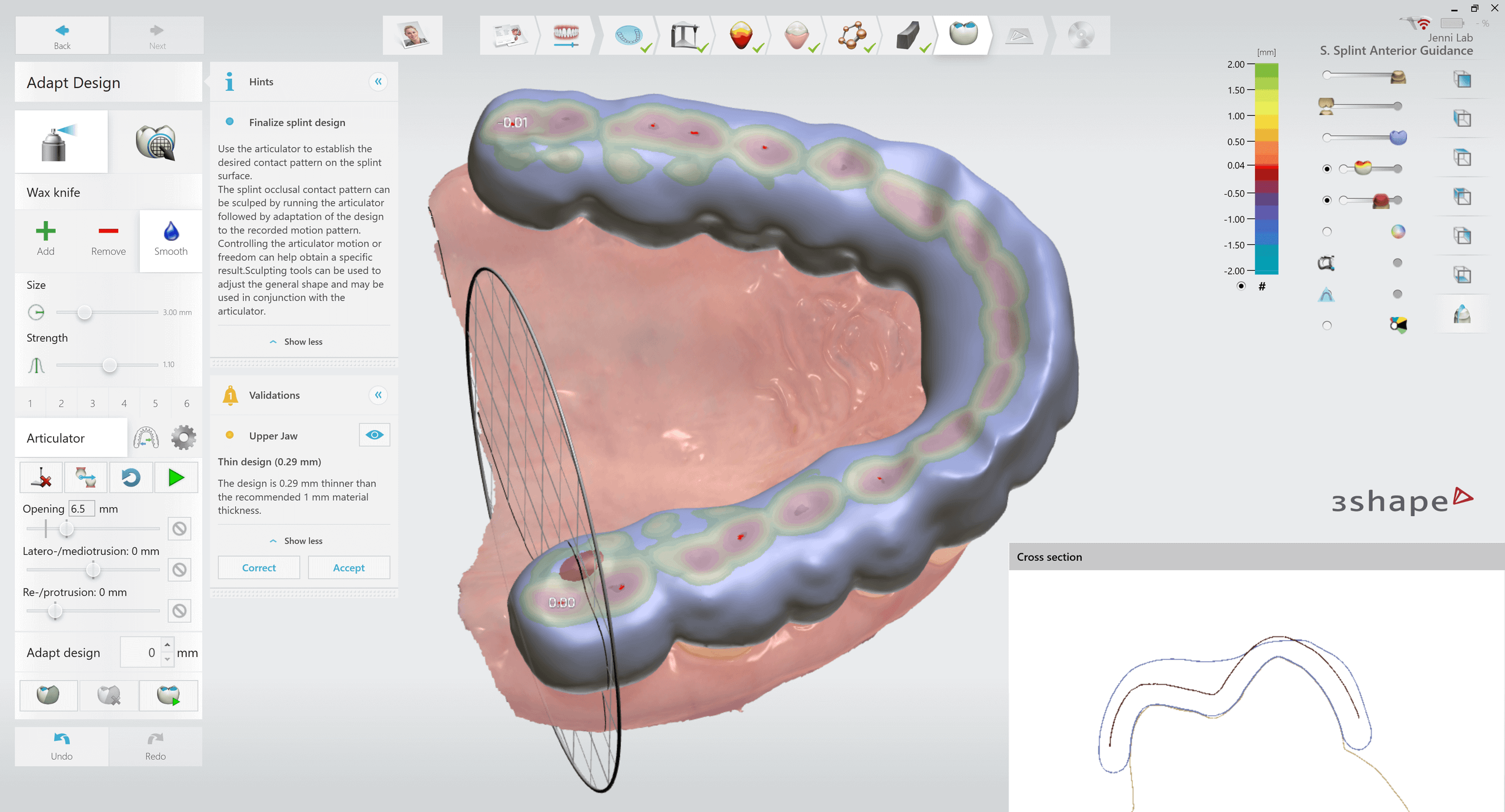 Splint Software 3Shape Splint Studio — Software Improvement and Changes