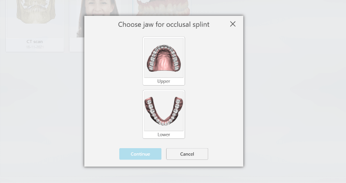 Splint Software 3Shape Splint Studio — Software Improvement and Changes