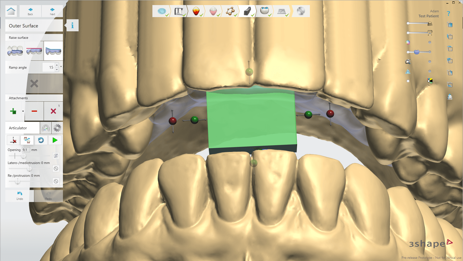 outside surface in Splint Studio