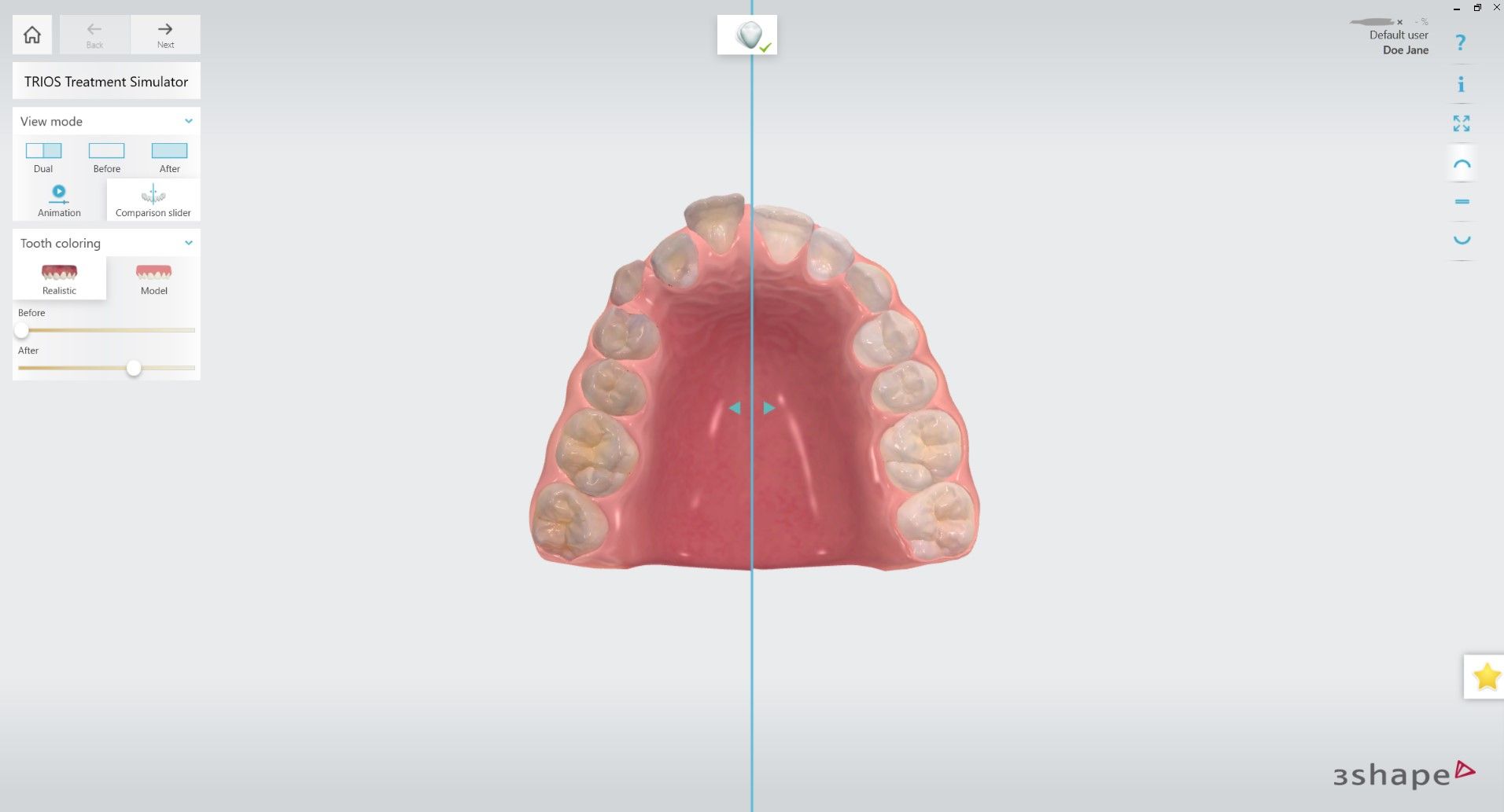 NEW Comparison slider