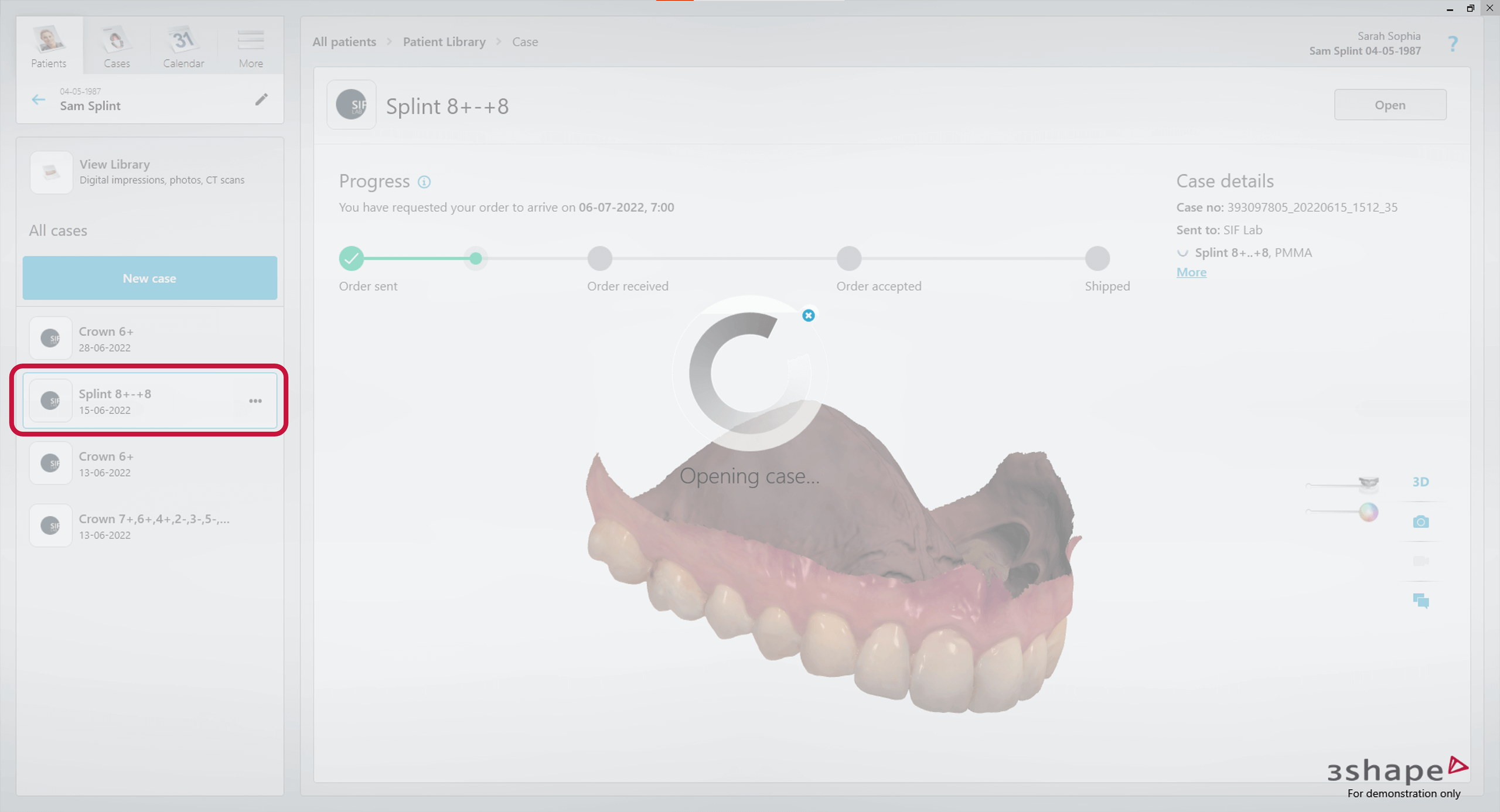 3Shape Unite — Software Improvement and Changes