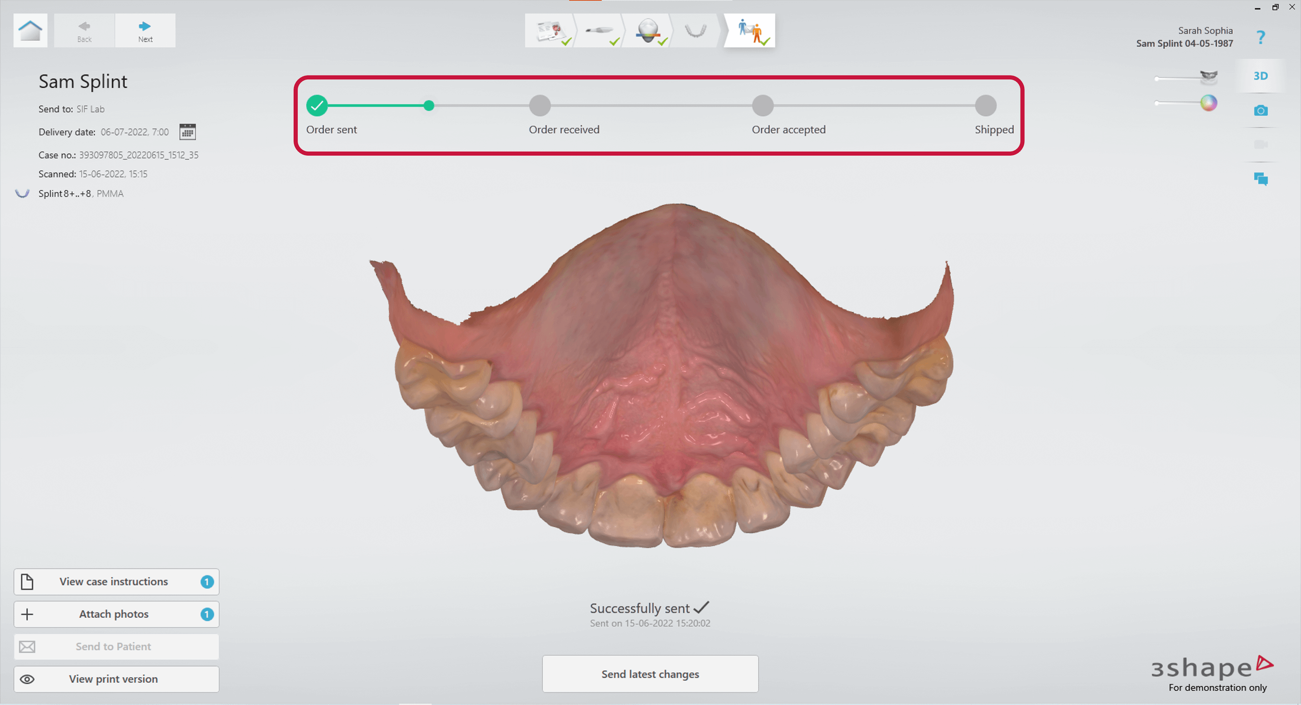 3Shape Unite — Software Improvement and Changes