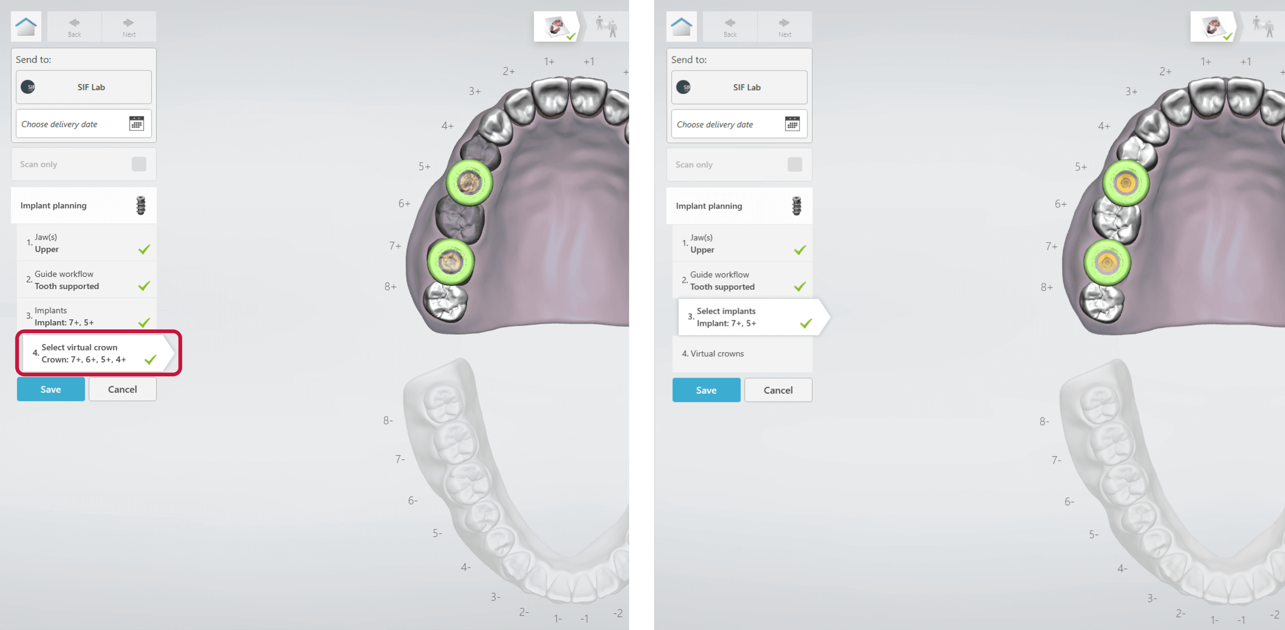3Shape Unite — Software Improvement and Changes