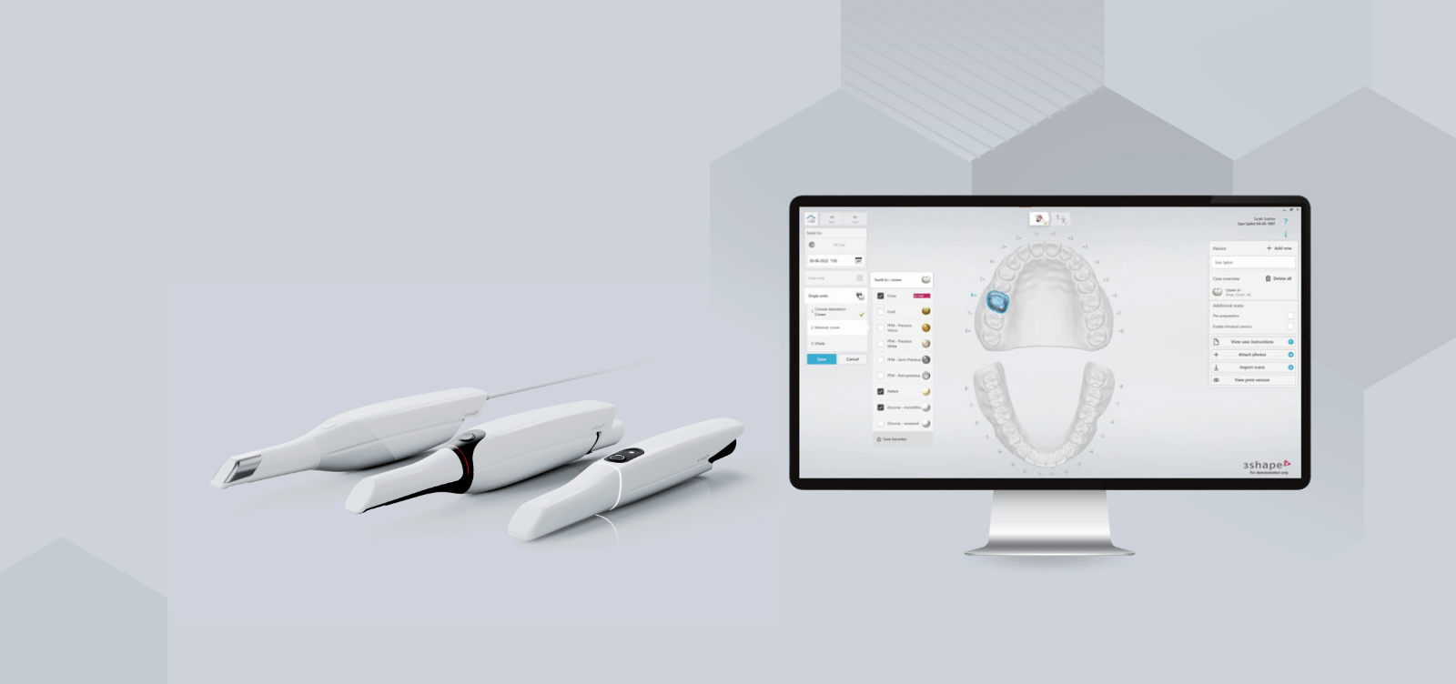 3Shape Unite — Software Improvement and Changes