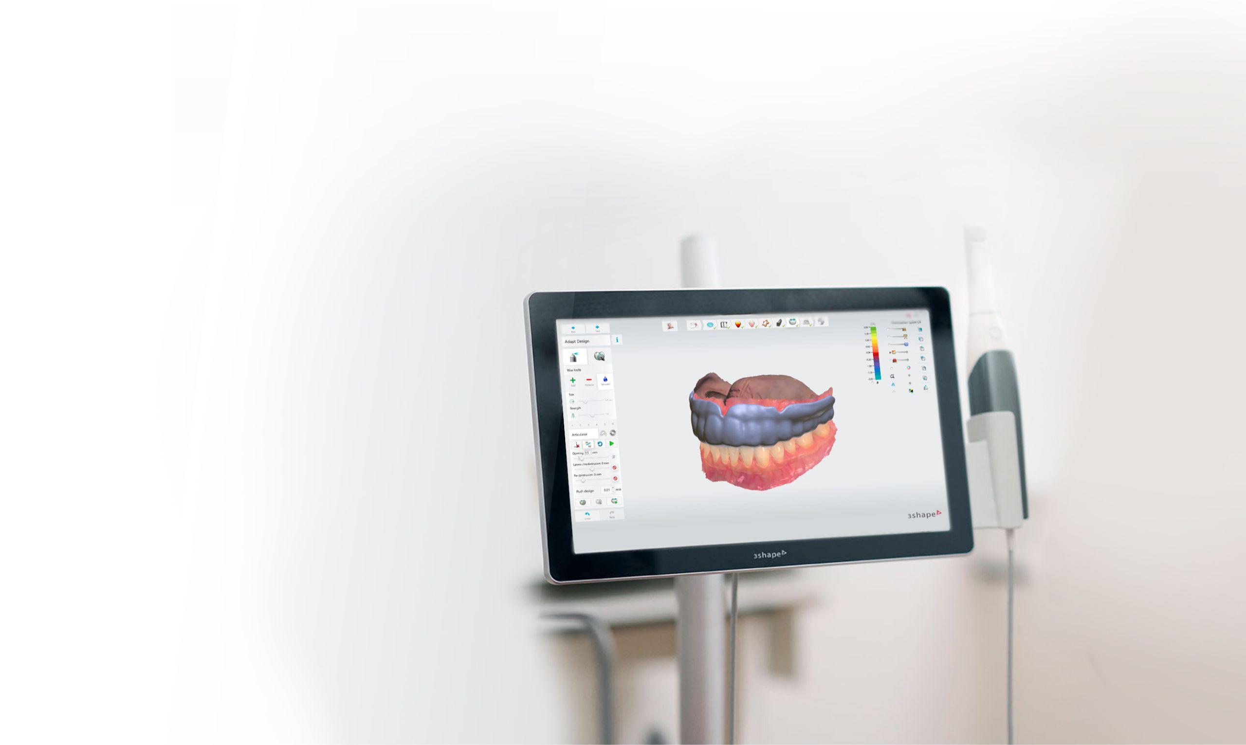 Verwendung von Splint Studio in Praxis