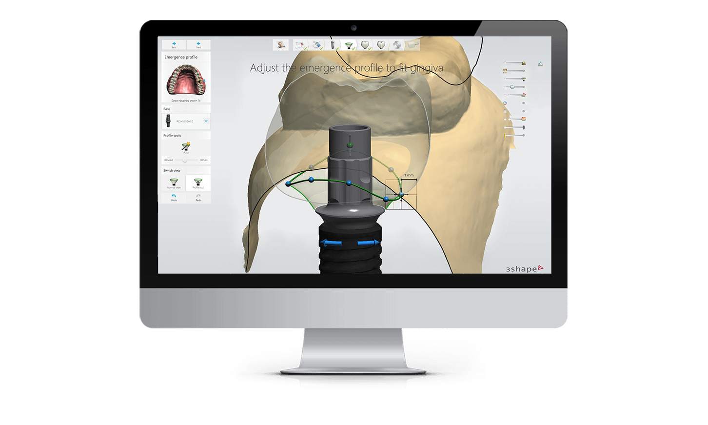3Shape Studio Apps - Boost Business with In-house Design & Production