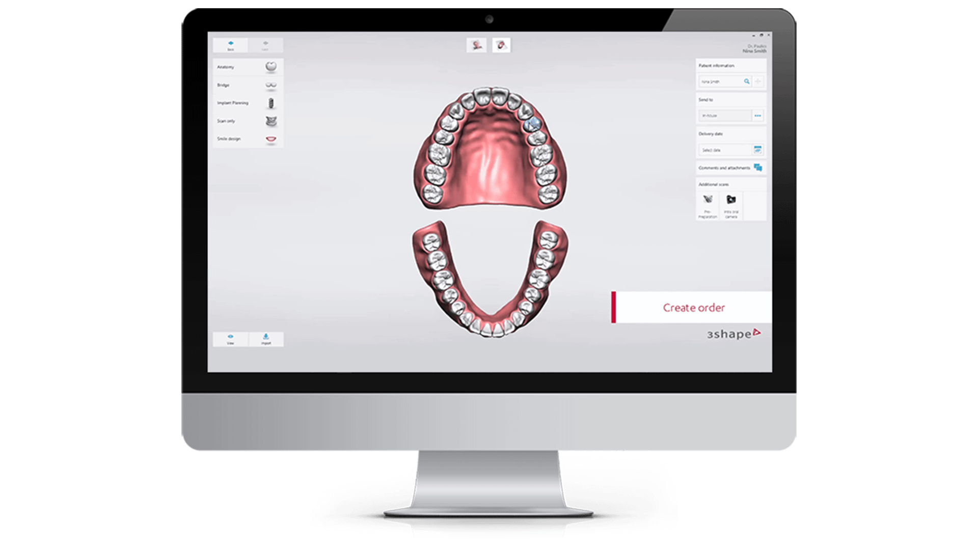 3shape Trios Design Studio Your Chairside Cad Cam Solution