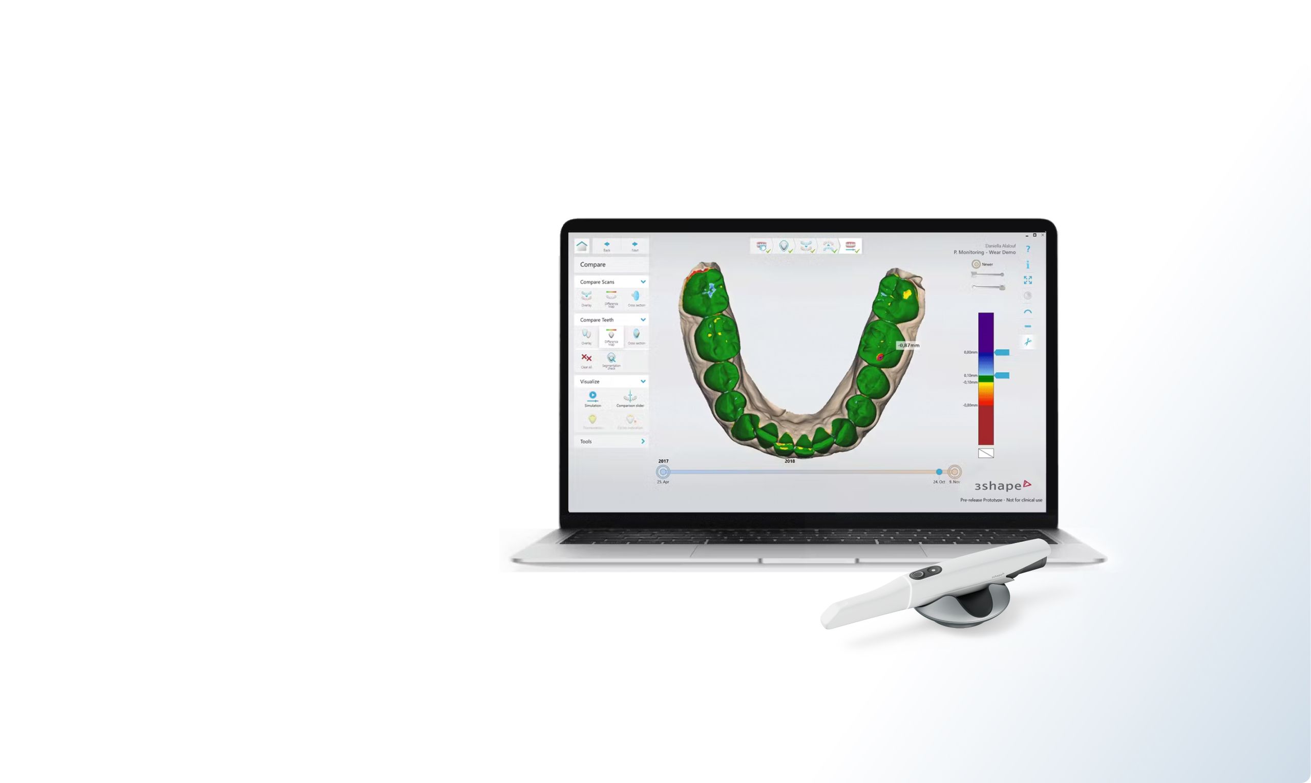 o uso do TRIOS patient monitoring na clínica