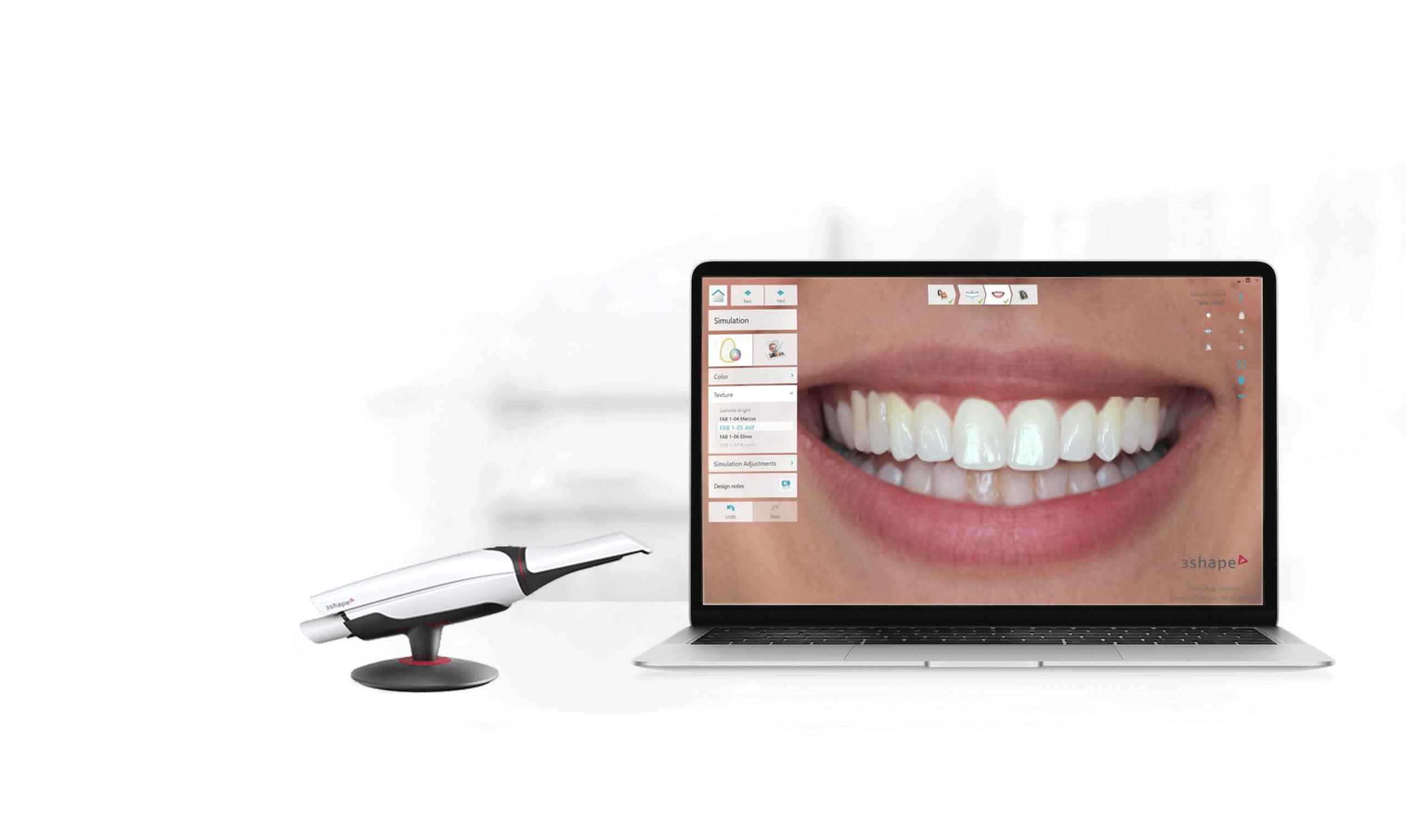 mejore las sonrisas y las vidas con TRIOS Smile Design