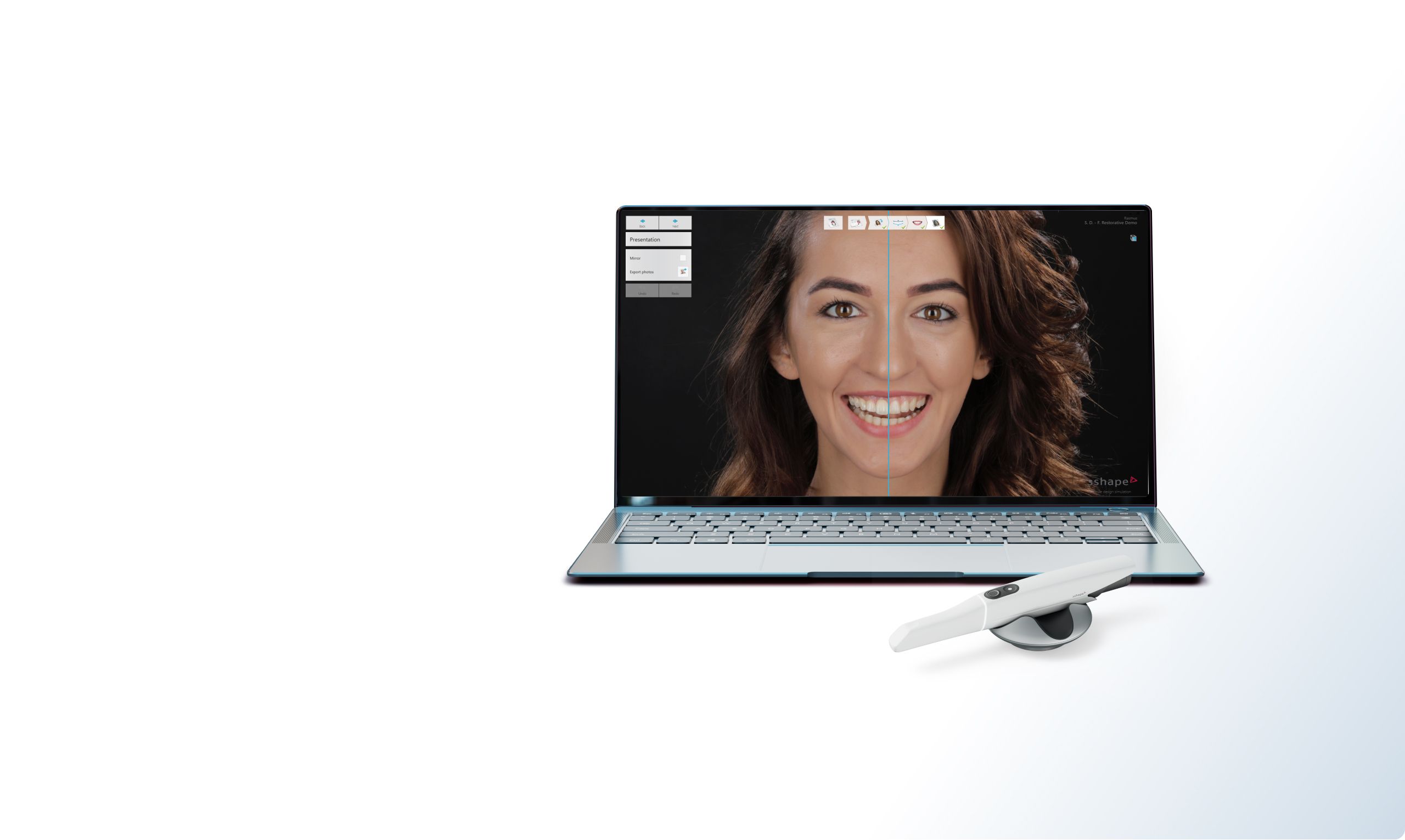 Améliorer les sourires et les vies avec TRIOS Smile Design