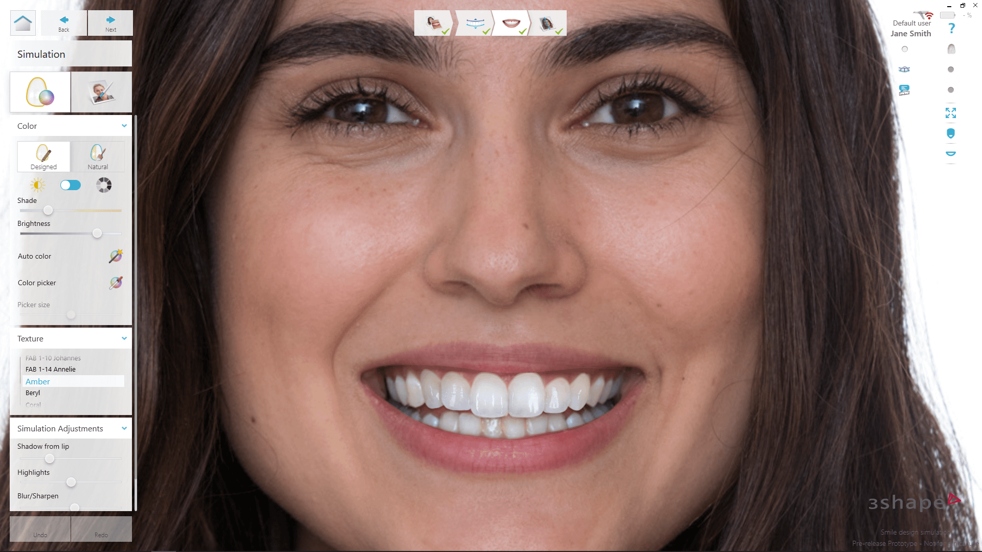 TRIOS Smile Design Software Improvement And Changes