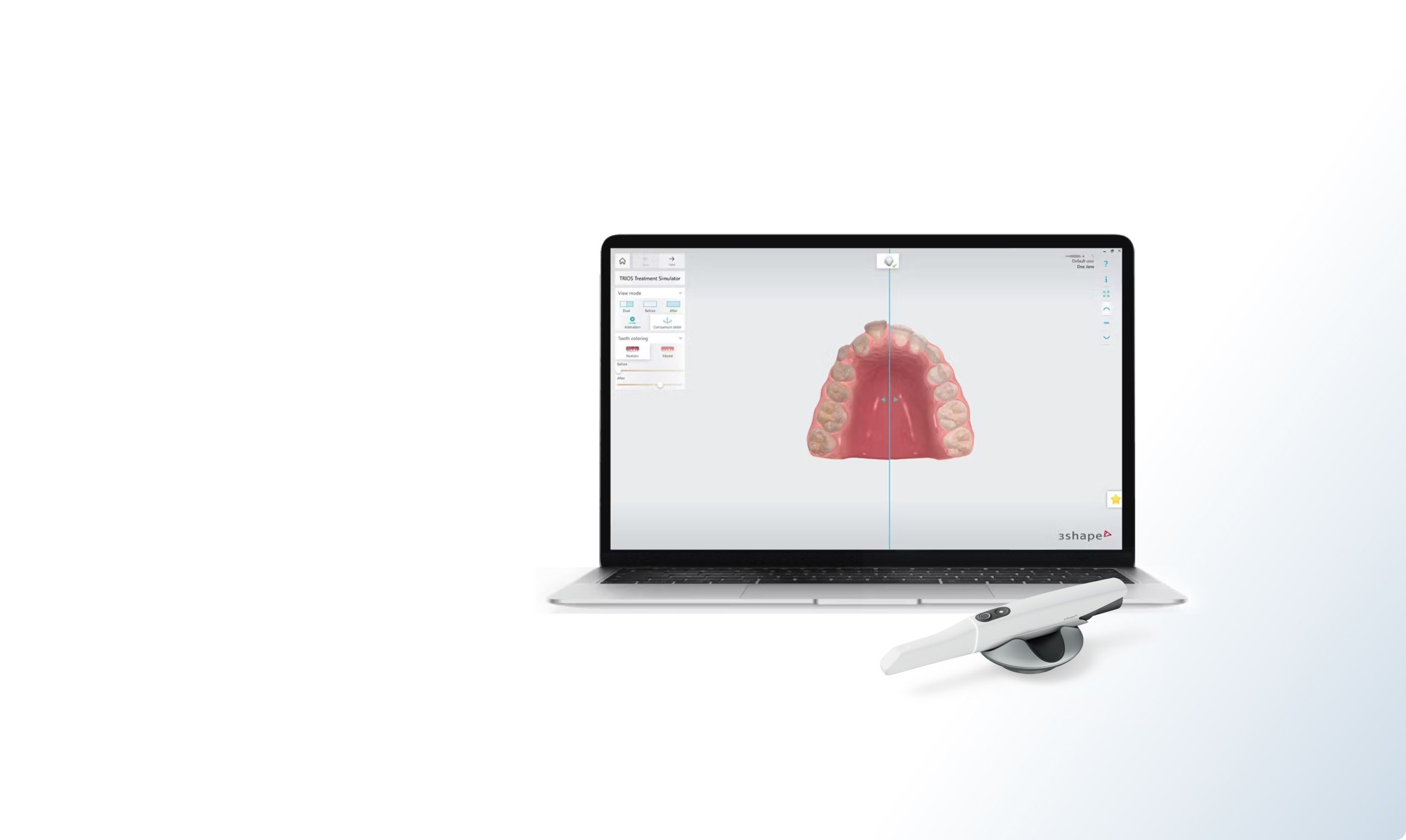 Correzioni ortodontiche sullo schermo