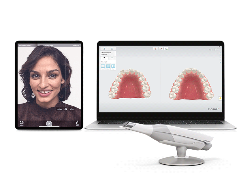 TRIOS Treatment Simulator scan workflow